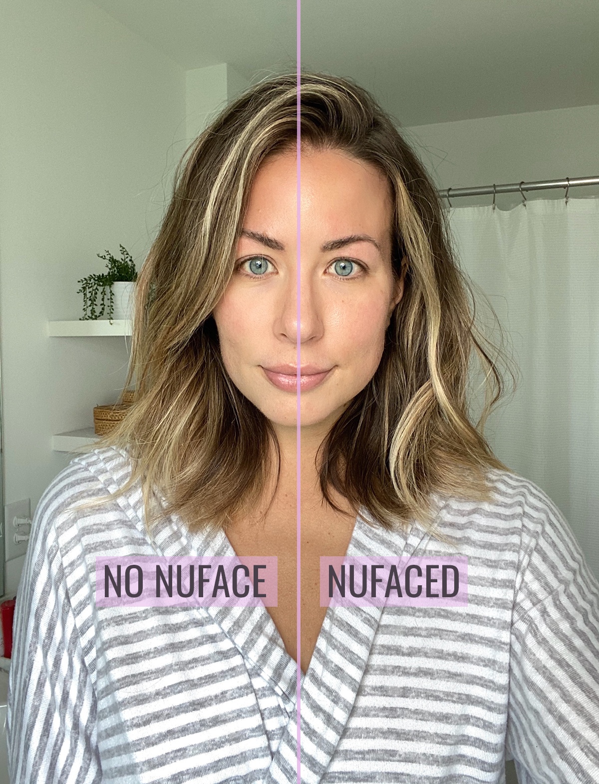 nuface before after